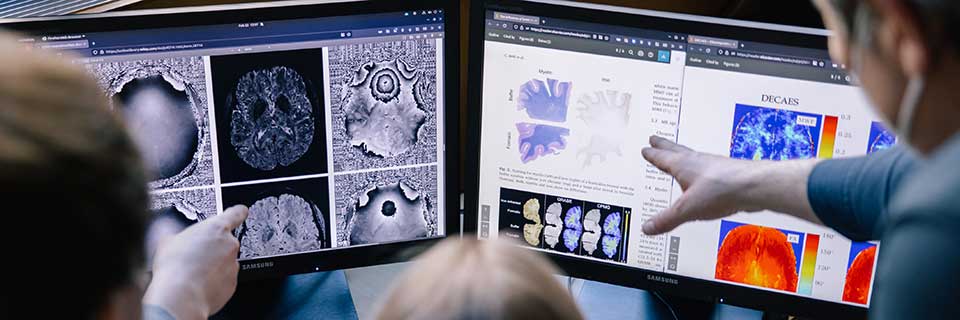Researchers looking at brain scans on two computer screens