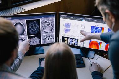 Researchers looking at brain scans on two computer screens