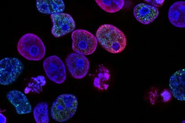 cancer cells